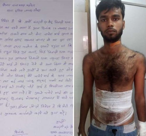 जनपद गोंडा चाकू मारकर युवक को किया लहूलुहान हालत गंभीर। रिपोर्ट :- पंकज कुमार सिंह।