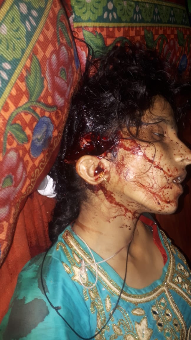 गर्भवती पत्नी और भाई को कुल्हाड़ी से काट डाला