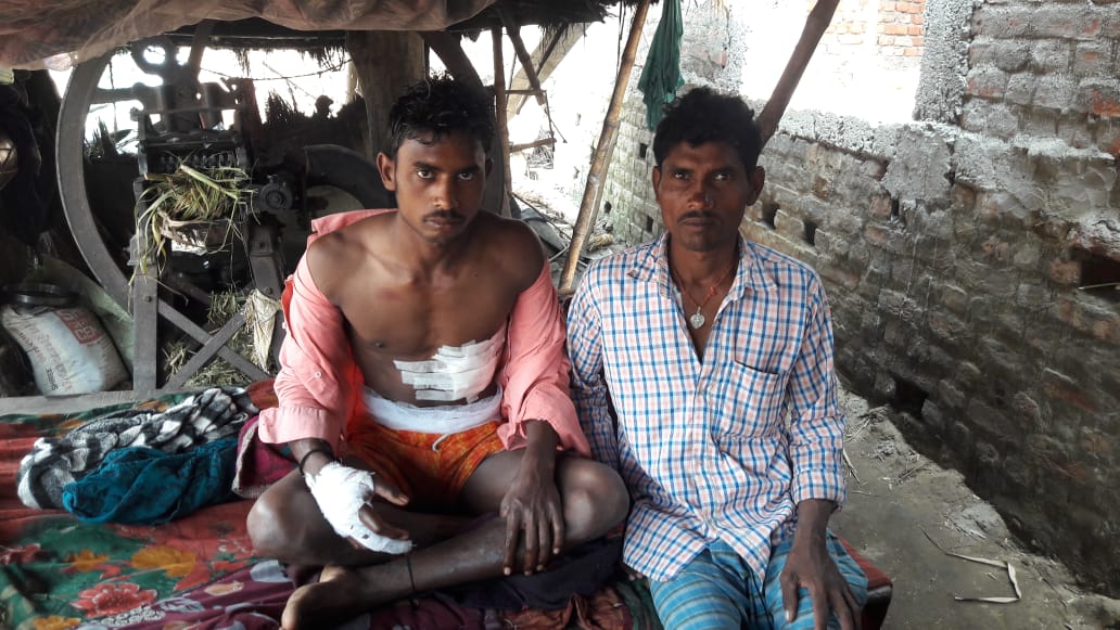जंगली सुअर के जानलेवा हमले में दो ग्रामीण बुरी तरह घायल।।
