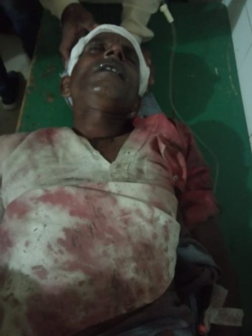 खेत में काम कर रहे व्यक्ति पर कुदाल से हमला इलाज के दौरान हुई मौत।