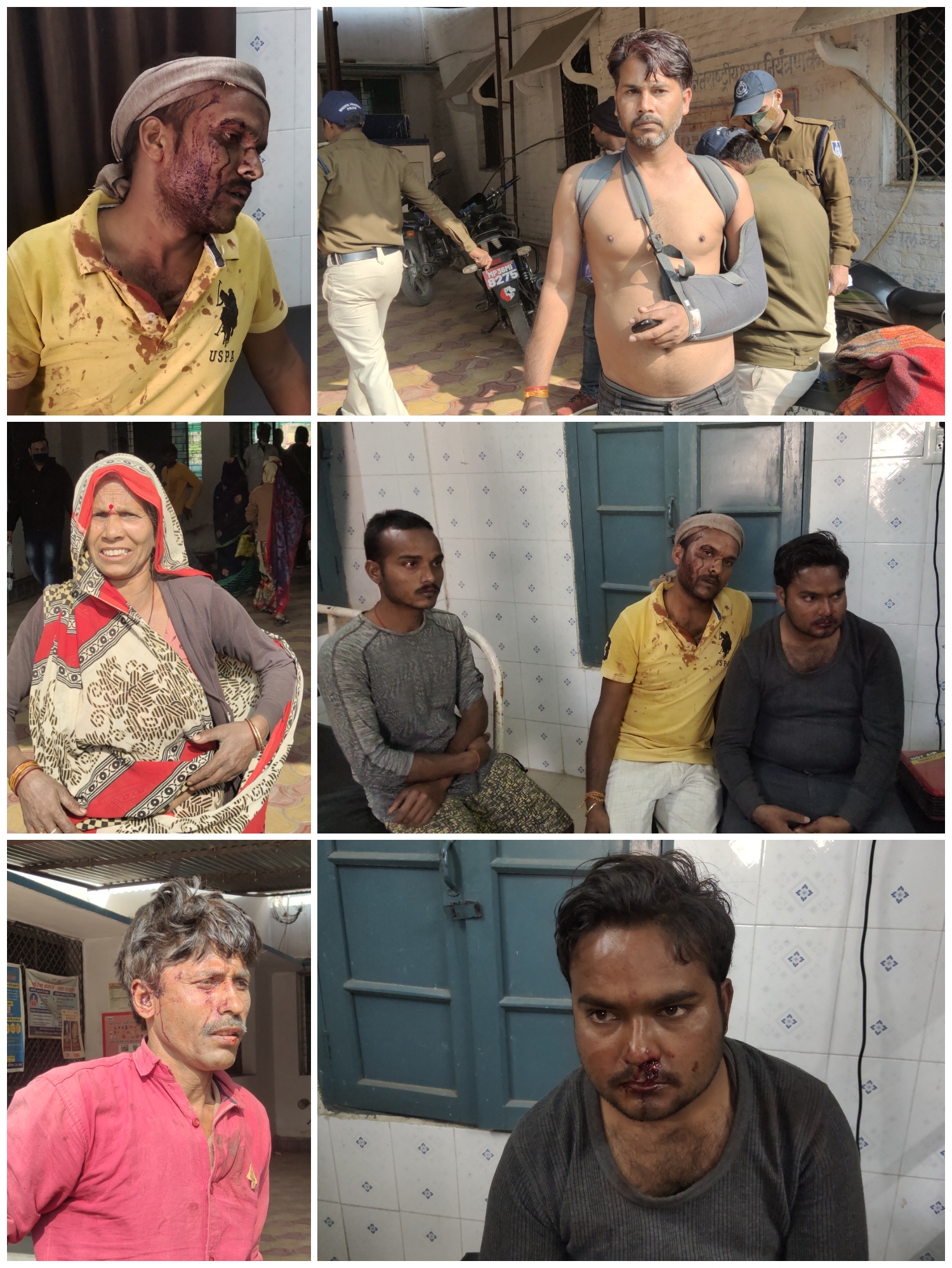 मामूली विवाद में दो पक्षों में जमकर चले लाठी-डंडे, आधा दर्जन से ज्यादा घायल।