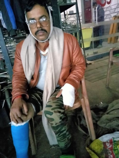 घर में घुसकर व्यापारी पर जानलेवा हमला दो के विरूद्ध मुकदमा दर्ज।