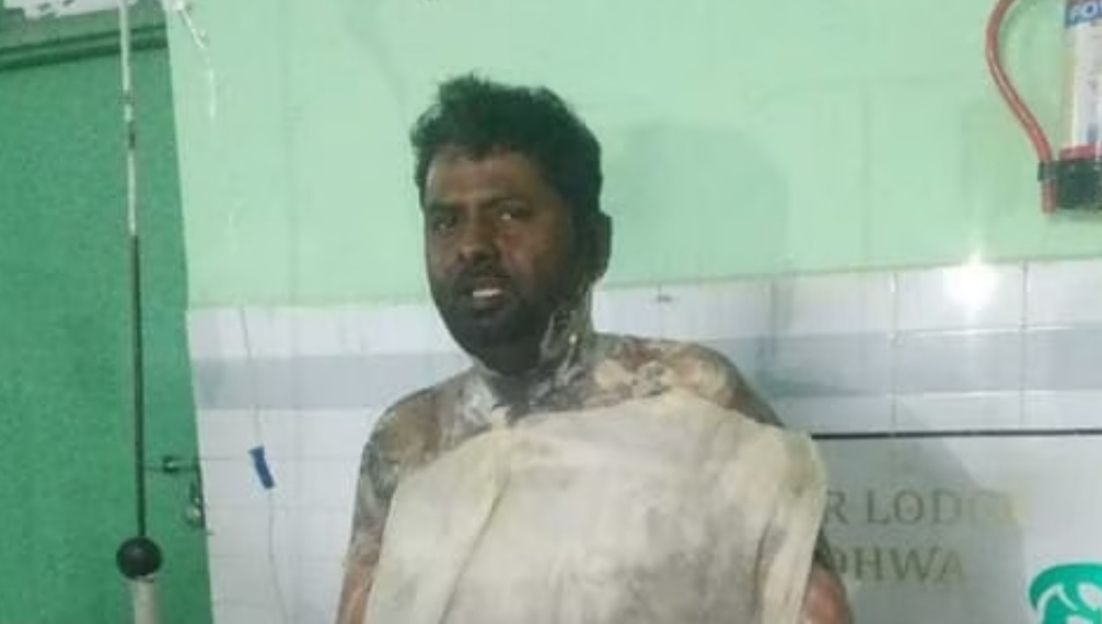 गौरीफंटा थाने के गेट पर युवक के आग लगाने से सनसनी, कोतवाल सस्पेंड