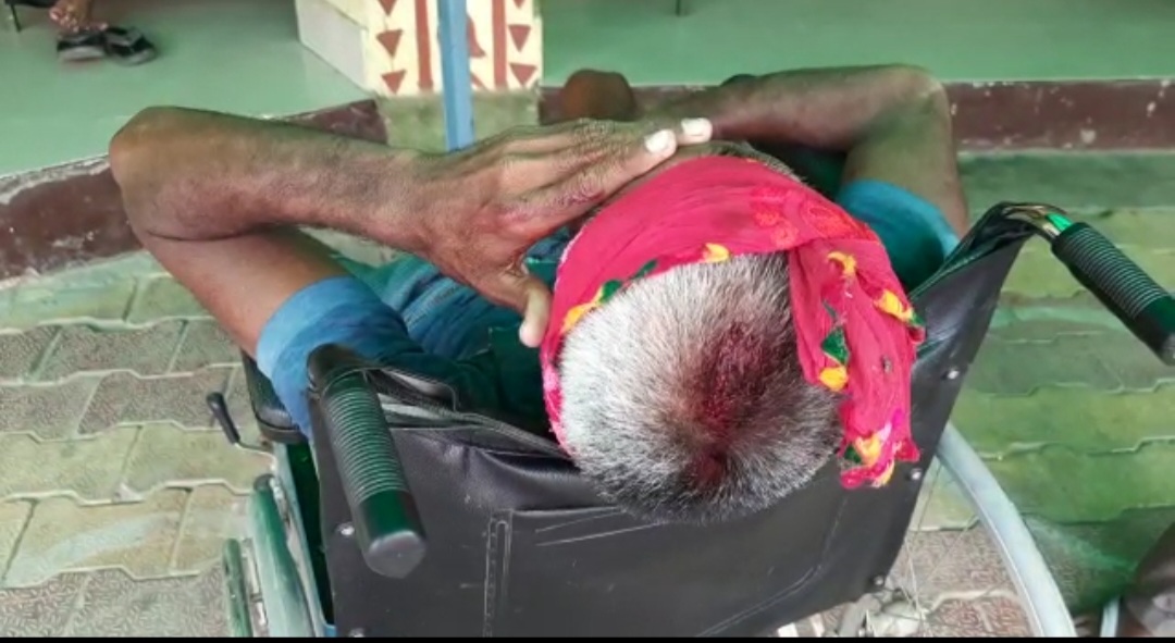 थाना राया क्षेत्र के बलदेव रोड स्थित गांव इटोली में दो पक्षों में विवाद हुई फायरिंग आधा दर्जन लोग घायल
