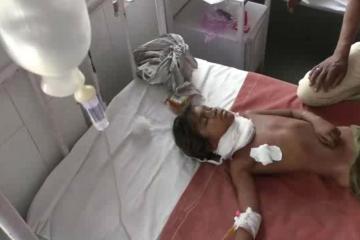 आदमखोर कुत्तों के हमले में घायल हुई बच्ची की मौत, मरने वालों की संख्या 14 हुई