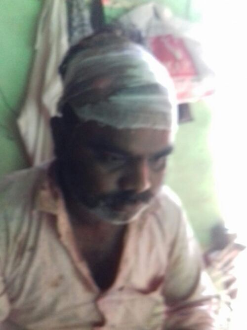 बहराइच ससुर ने हमला कर दामाद व समधी को किया घायल  तीन हजार रूपये छीनकर हुए फरार।।  रिपोर्ट :- पंकज कुमार सिंह।
