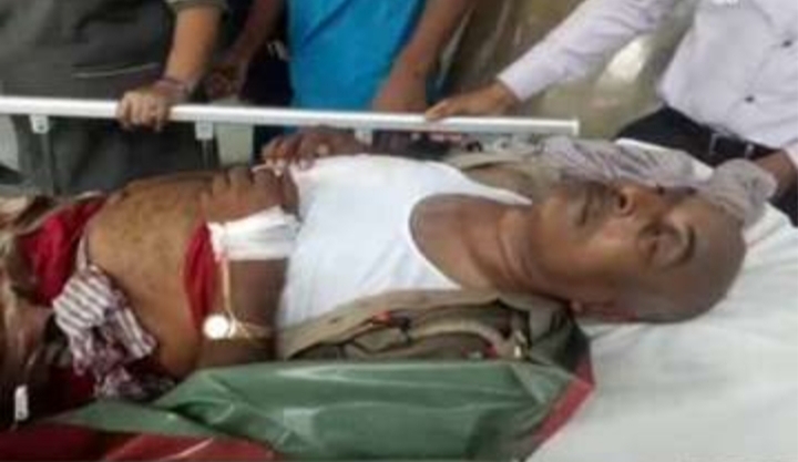 बदमाशों ने दरोगा को मारी गोली, कुख्यात अपराधी को कस्टडी से छुड़ाकर फरार