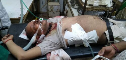 बहराइच-06-07-2019 को श्री प्रभात कुमार सोनी प्रभारी प्रधान शिक्षक पूर्व मा0विद्यालय-बंजरिया,विकास खण्ड-विशेश्वरगंज का हुआ भीषण हादसा। रिपोर्ट पंकज कुमार सिं
